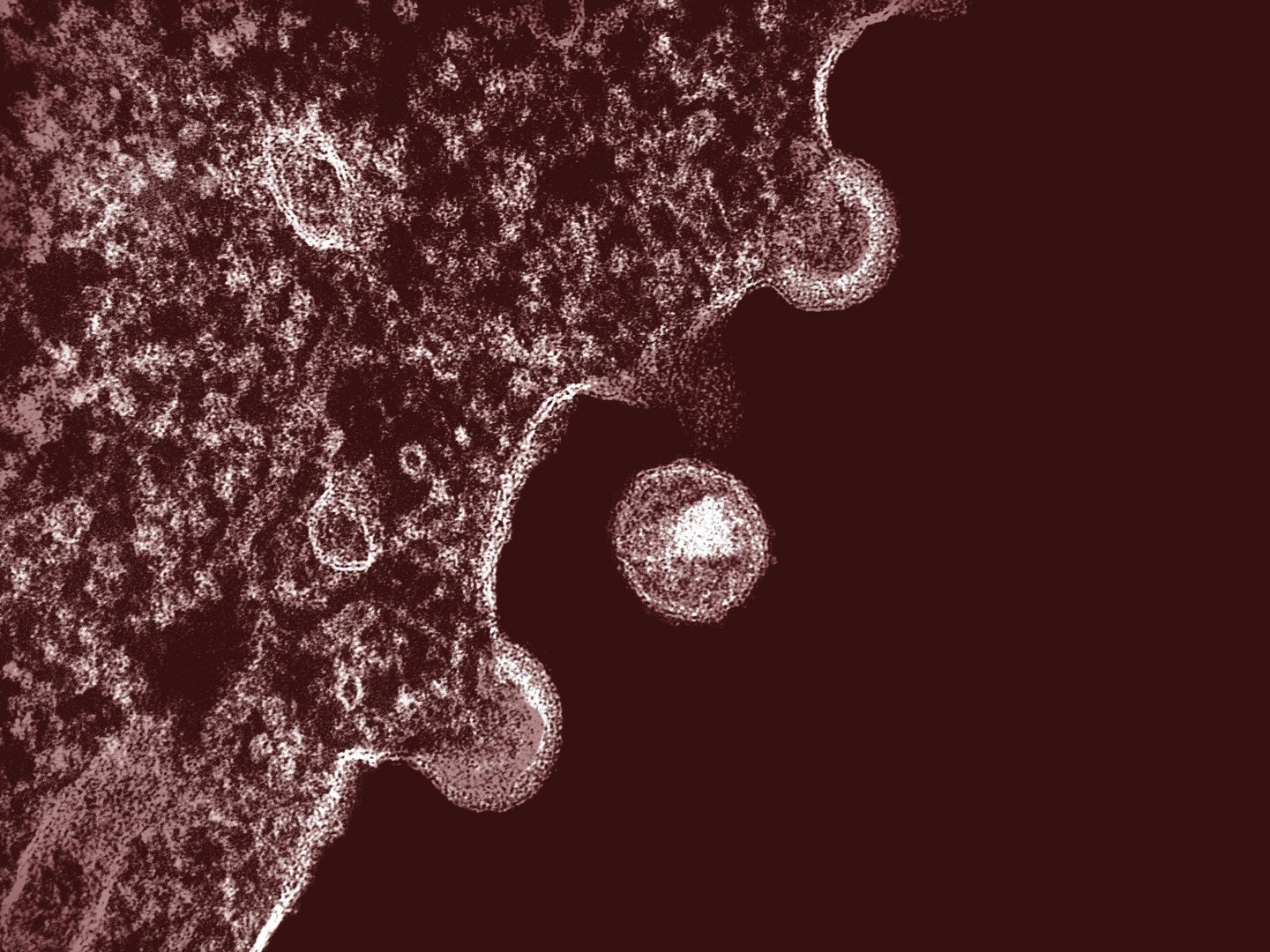 Image credit: National Institute of Allergy and Infectious Diseases from Unsplash