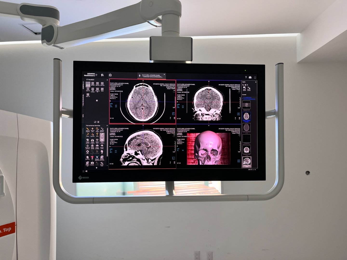 Bolsa de Trabajo ISSSTE Técnico Radioterapia en ISSSTE