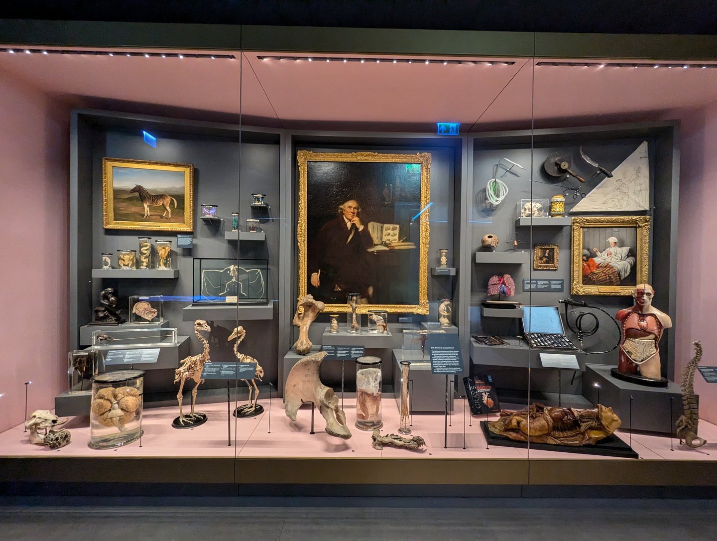 A case in the Hunterian Museum, London.