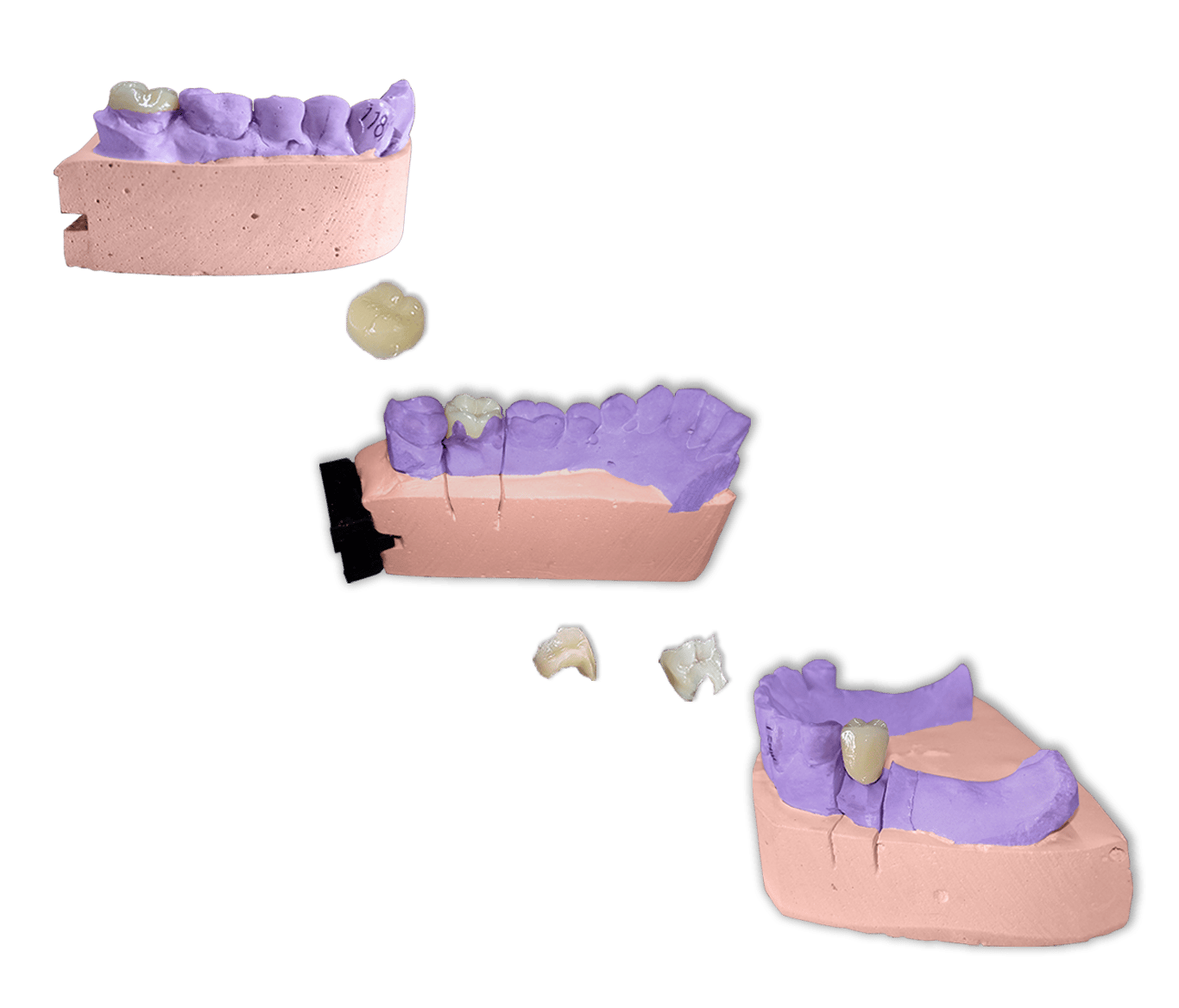 Protesis Fija Estetica Ceromero Signum