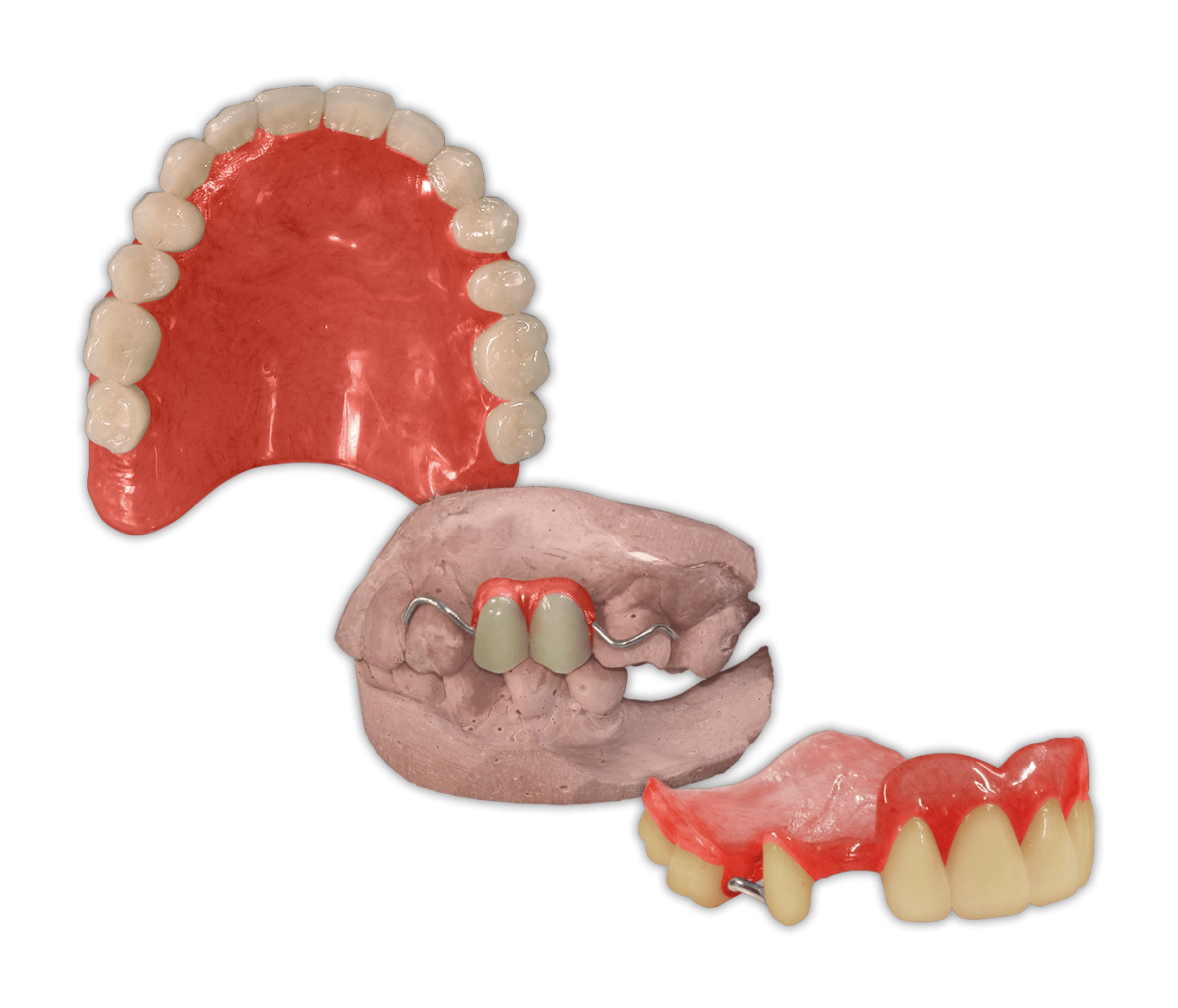 Protesis-Removible-Provisional-Acrilico-Rapido