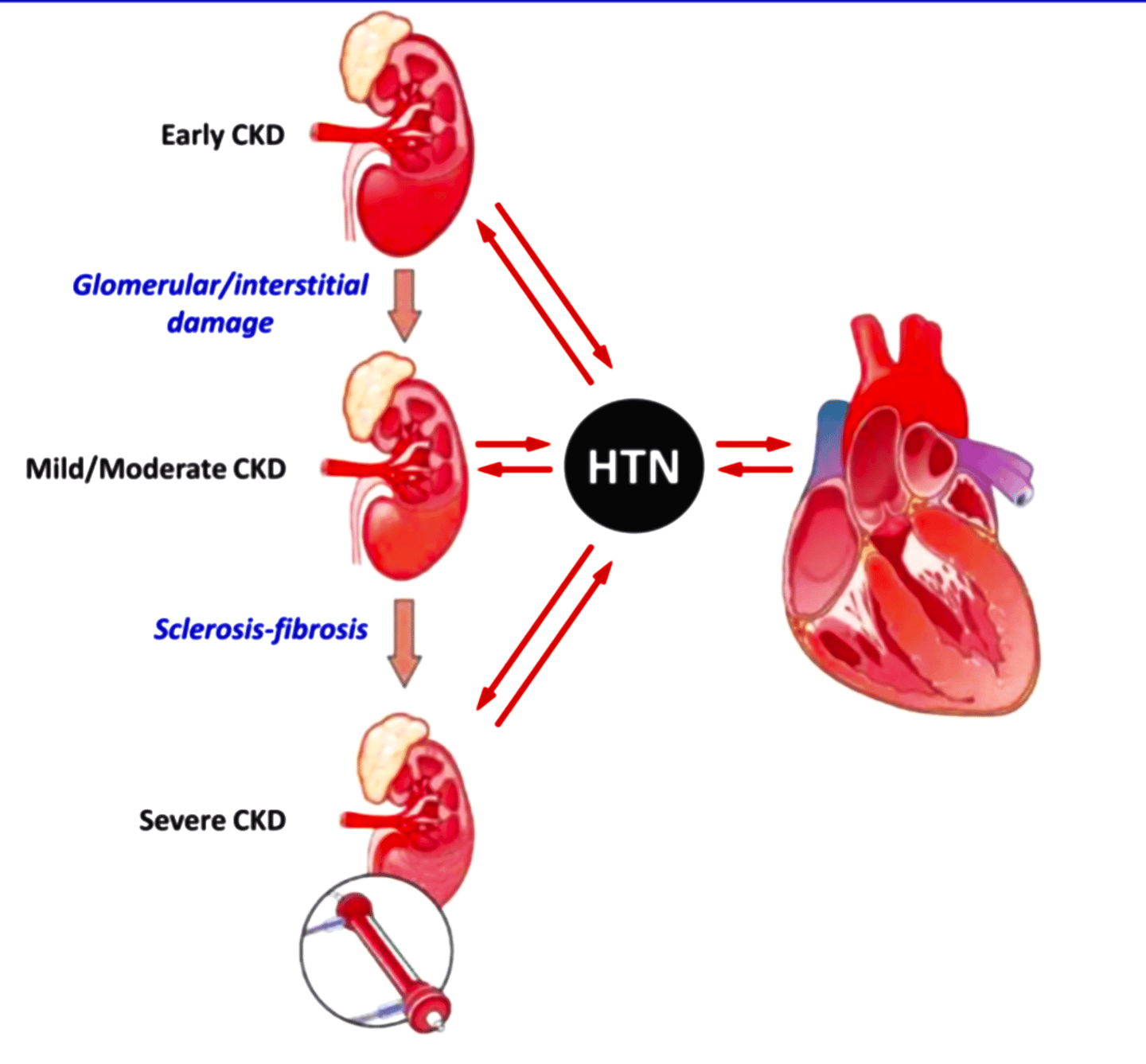 Kidney & Heart disease and their relationship 