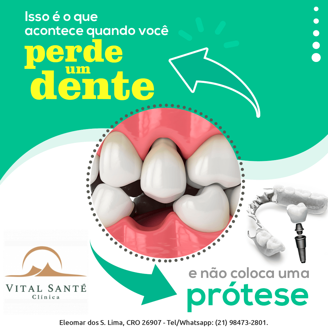 Perda de um dente