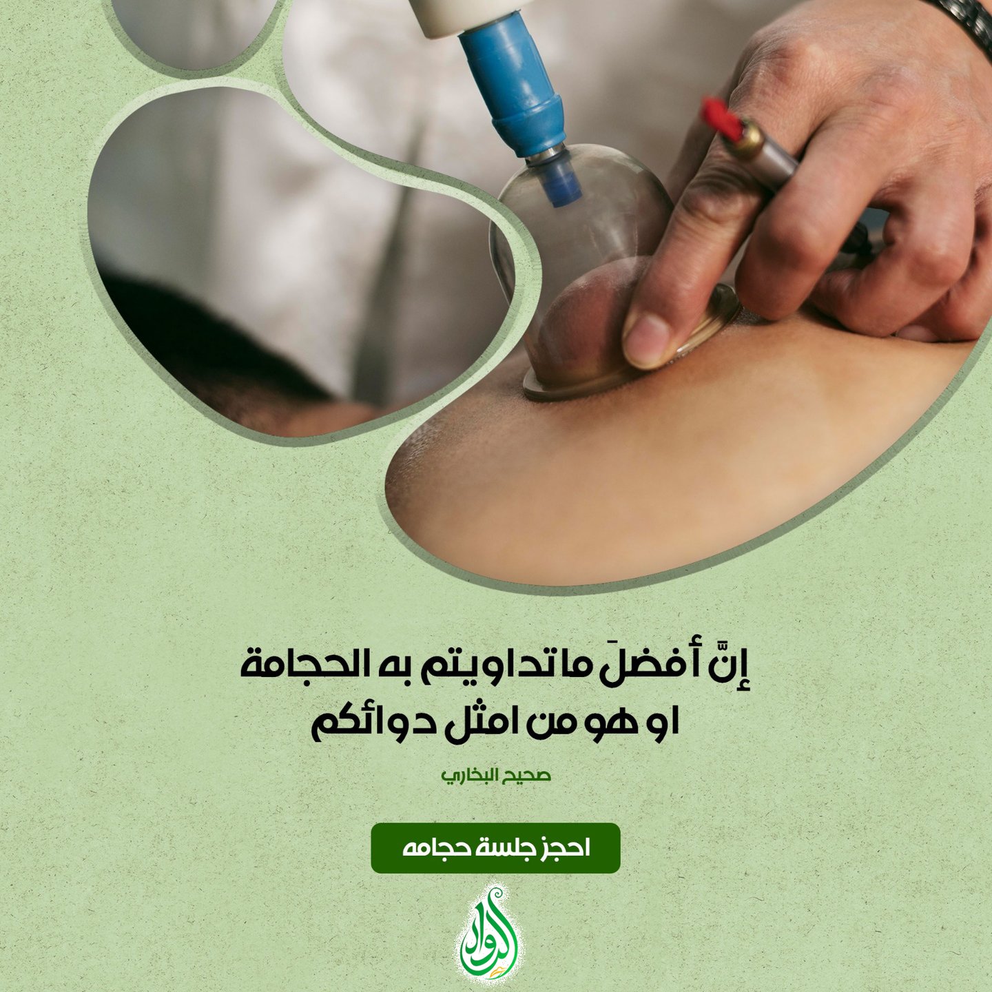 حجامه الرياض