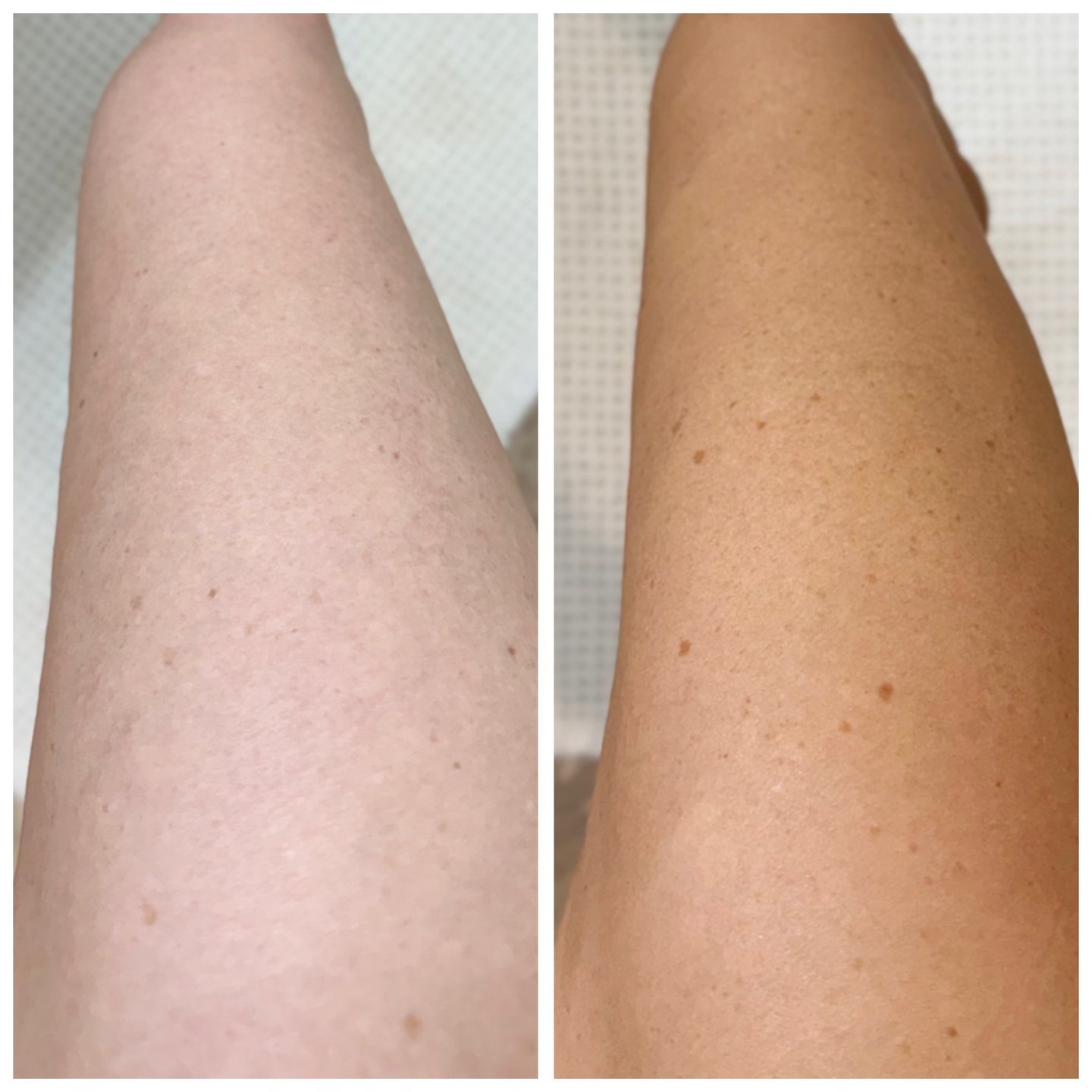 before and after sjolie no. 9