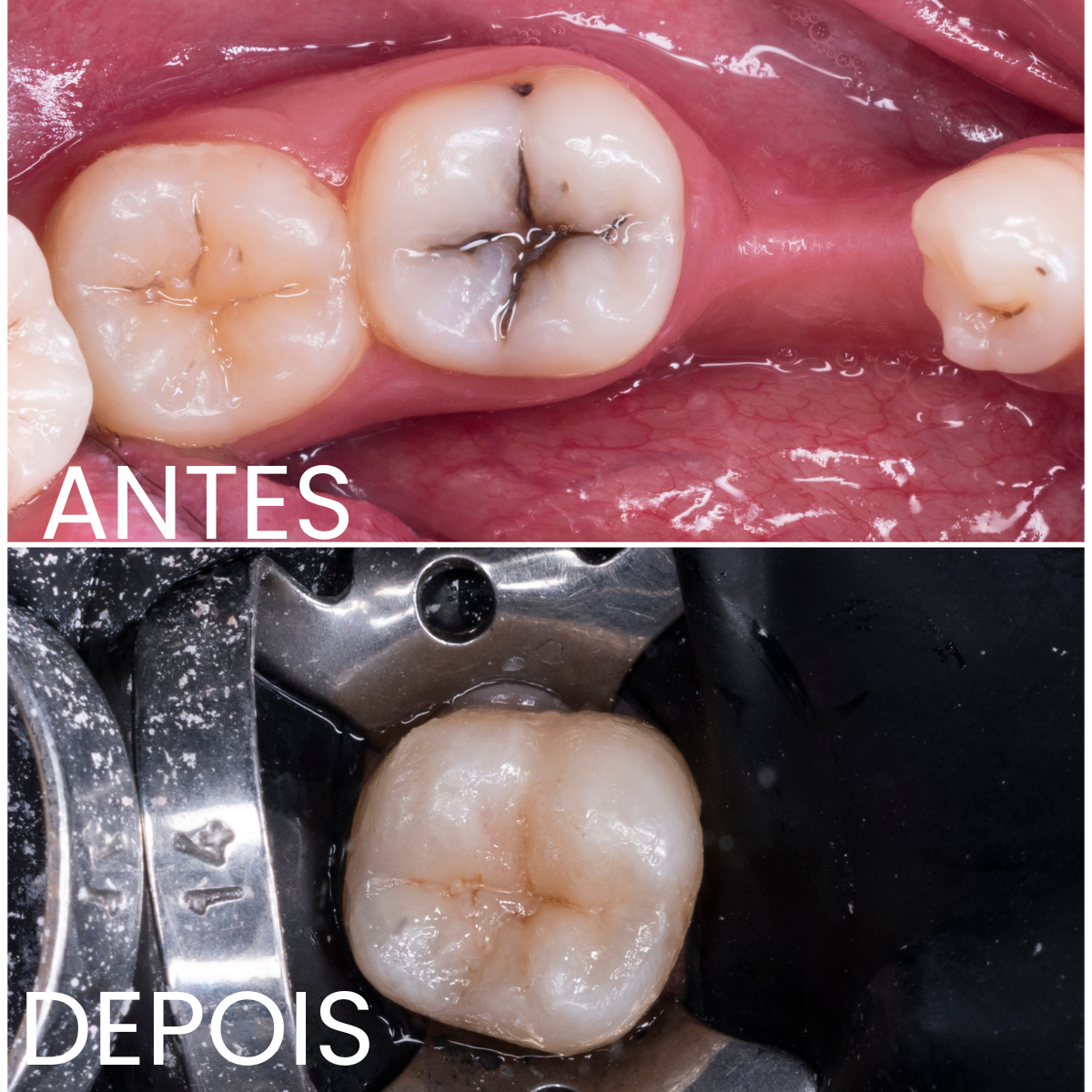 Clínica especializada em dentisteria e tratamento de cáries em Setúbal.