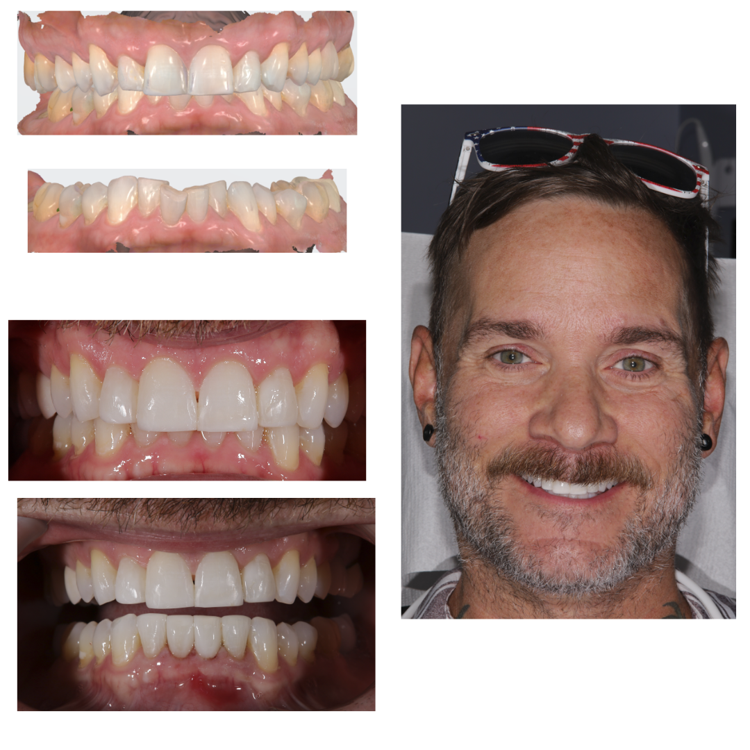 collage of man's smile