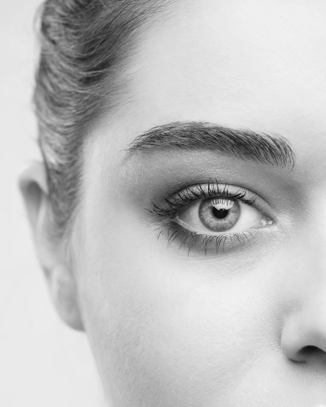 Cirujano plástico Bogotá párpados | Blefaroplastia