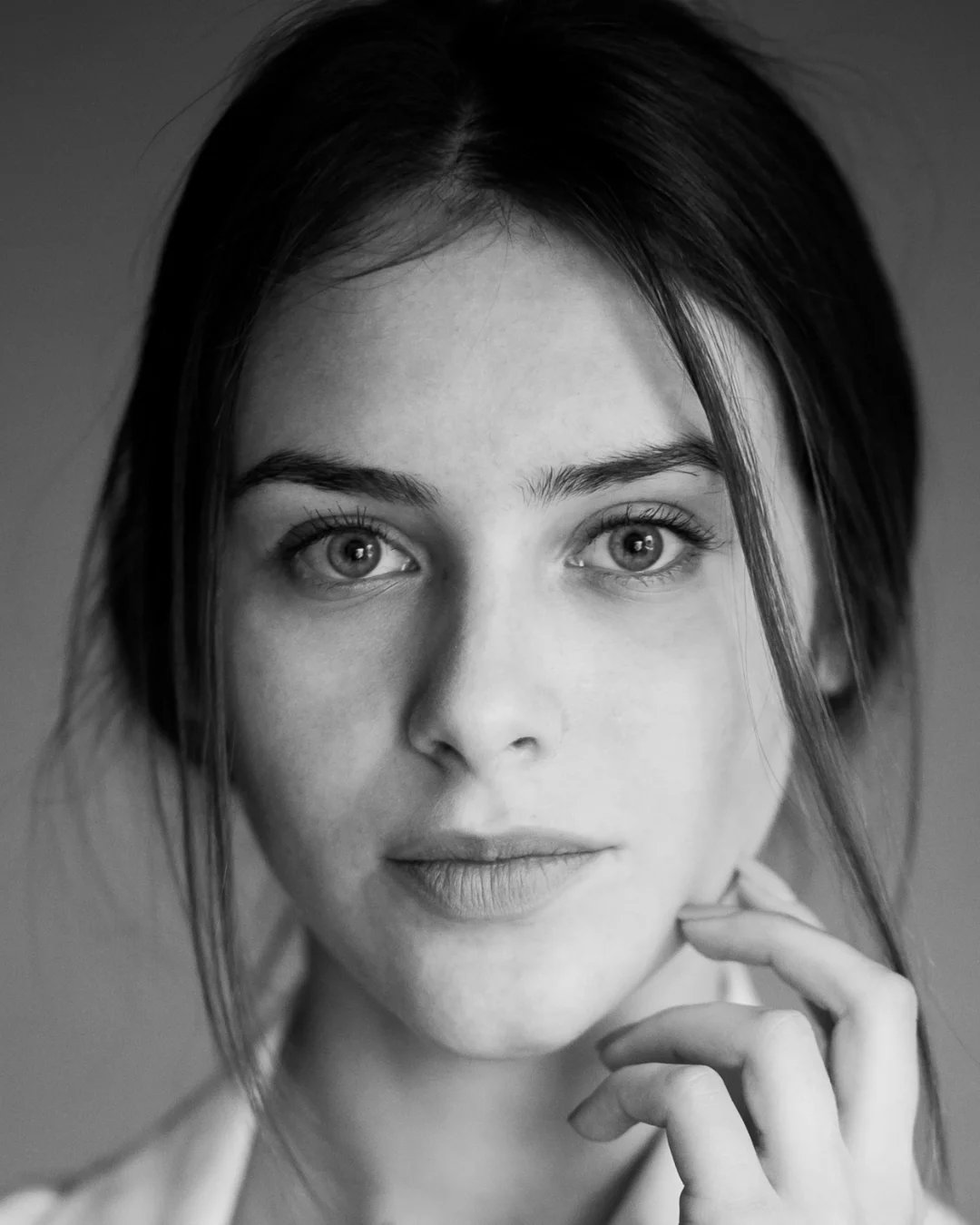 Cirujano plástico Bogotá mentón | Mentoplastia