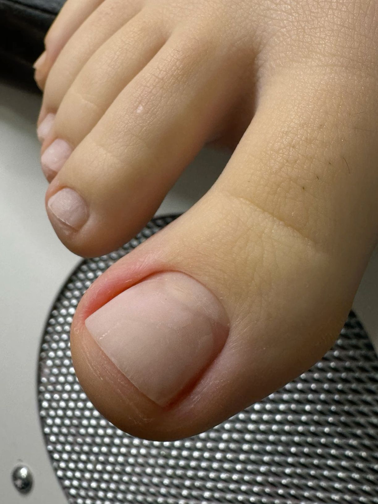 Higieninis pedikiūras