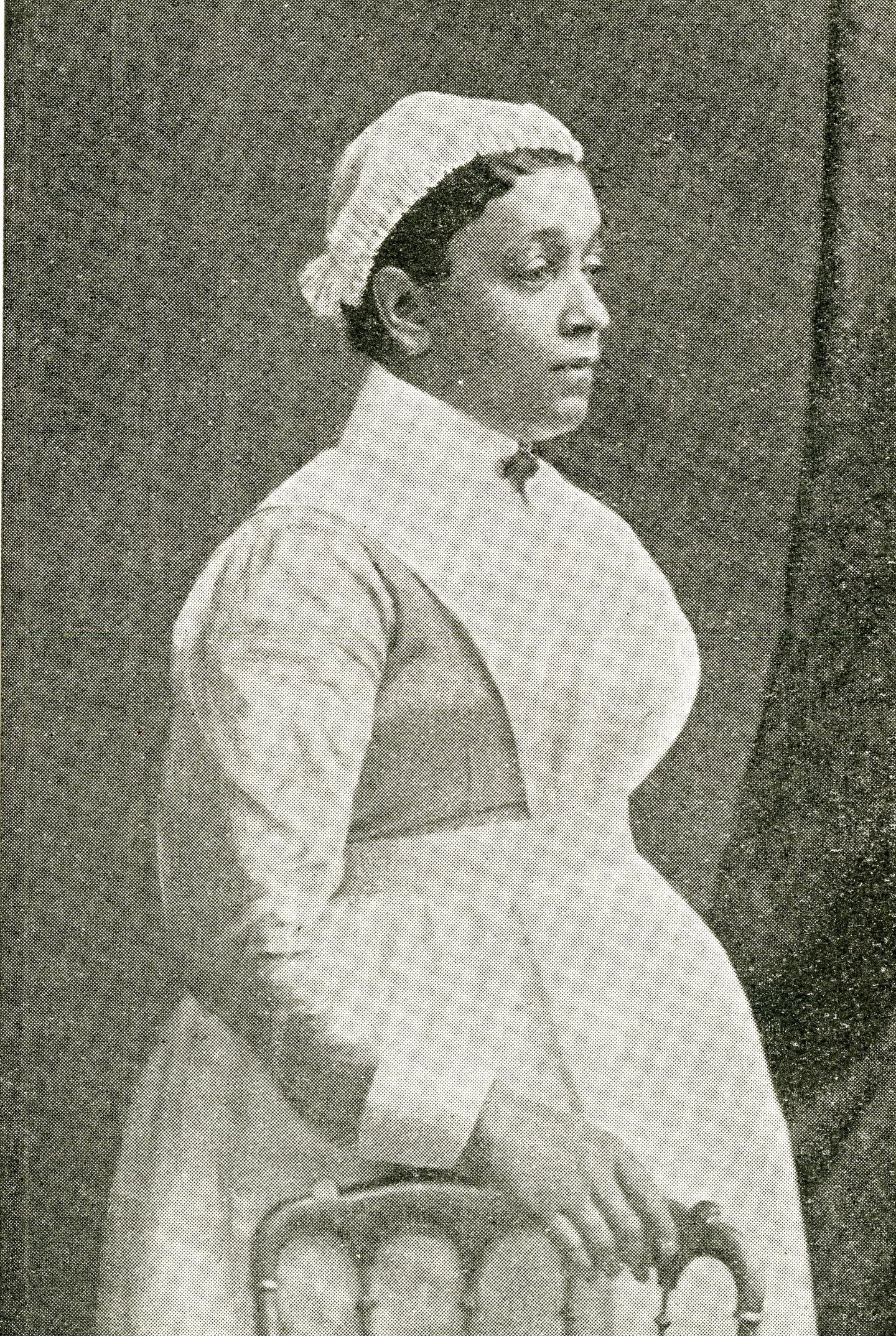 Nurse Ophthalmic Annie Brewster pioneer and icon