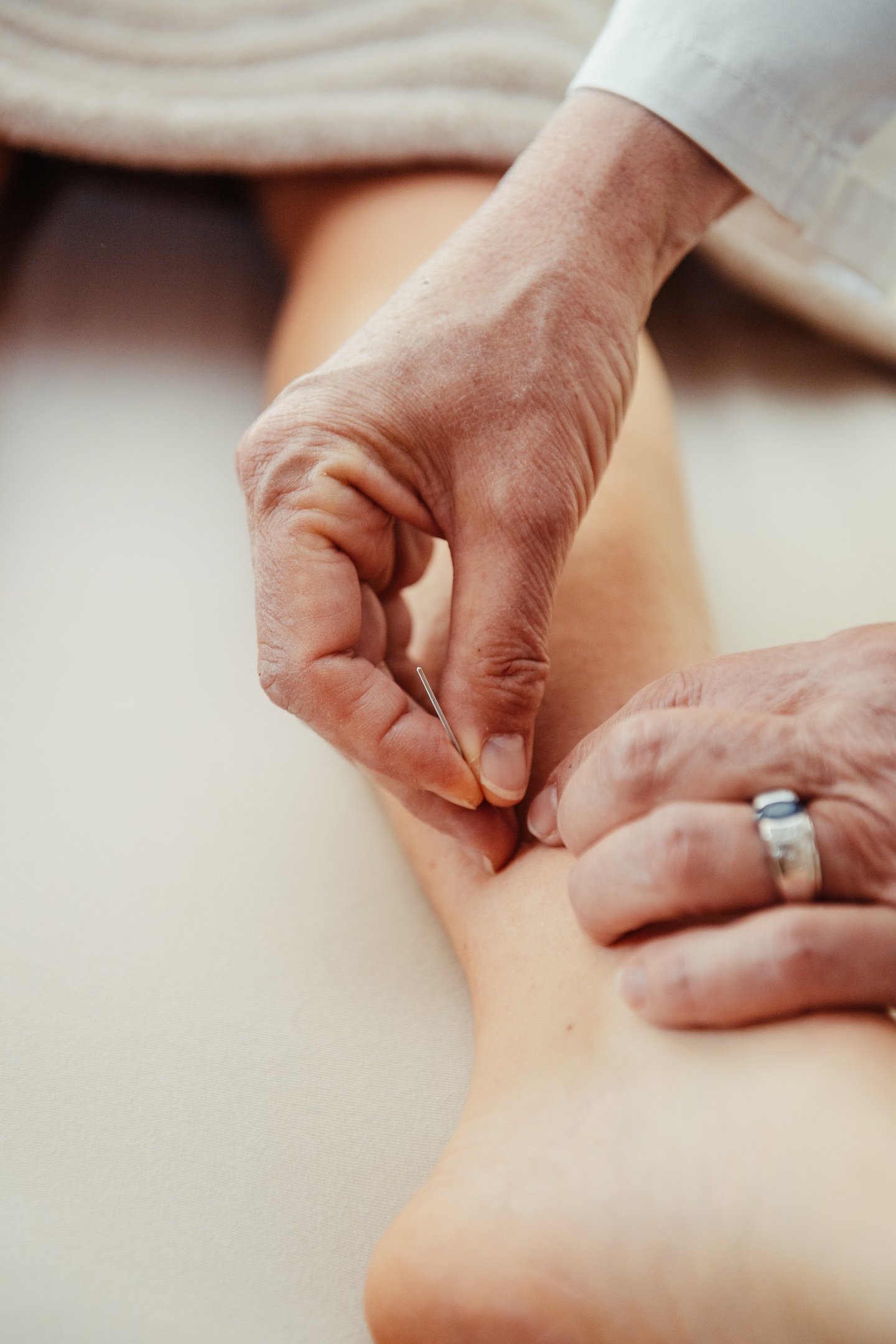 stimulation des méridiens