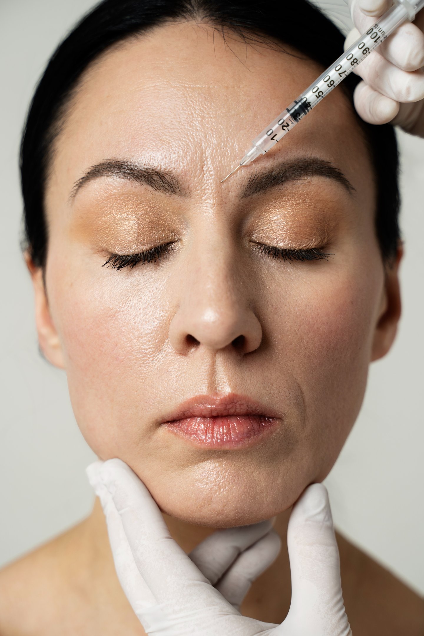 botox preventivo Dra. Raphaela Dafne Tatuapé