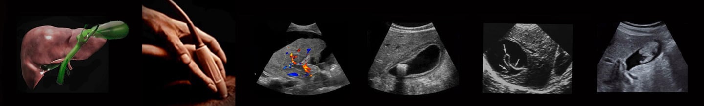 Panel of abdominal ultrasound images and Doppler.