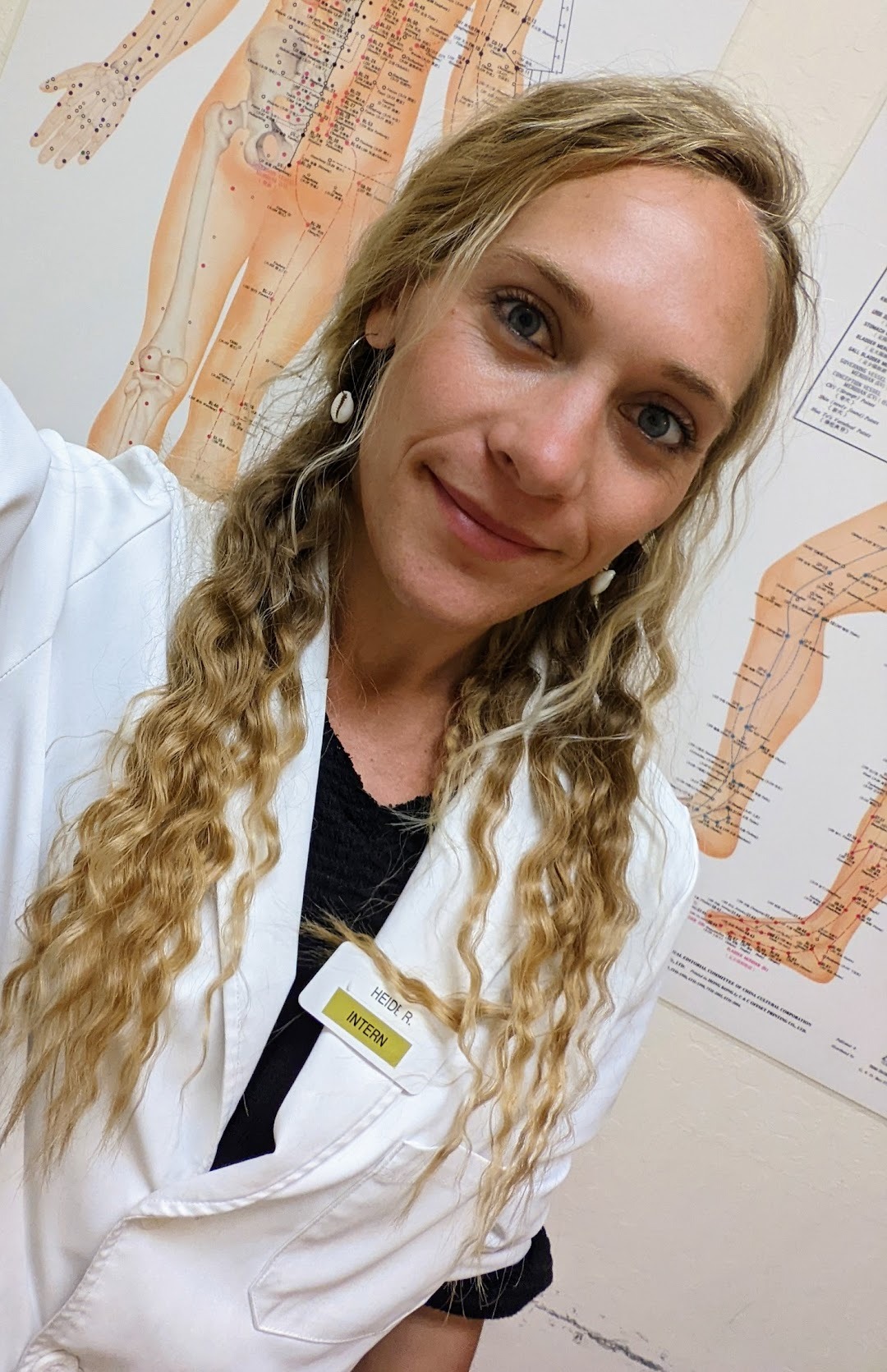 blonde acupuncture intern in a white lab coat posing in front of anatomical meridian charts.