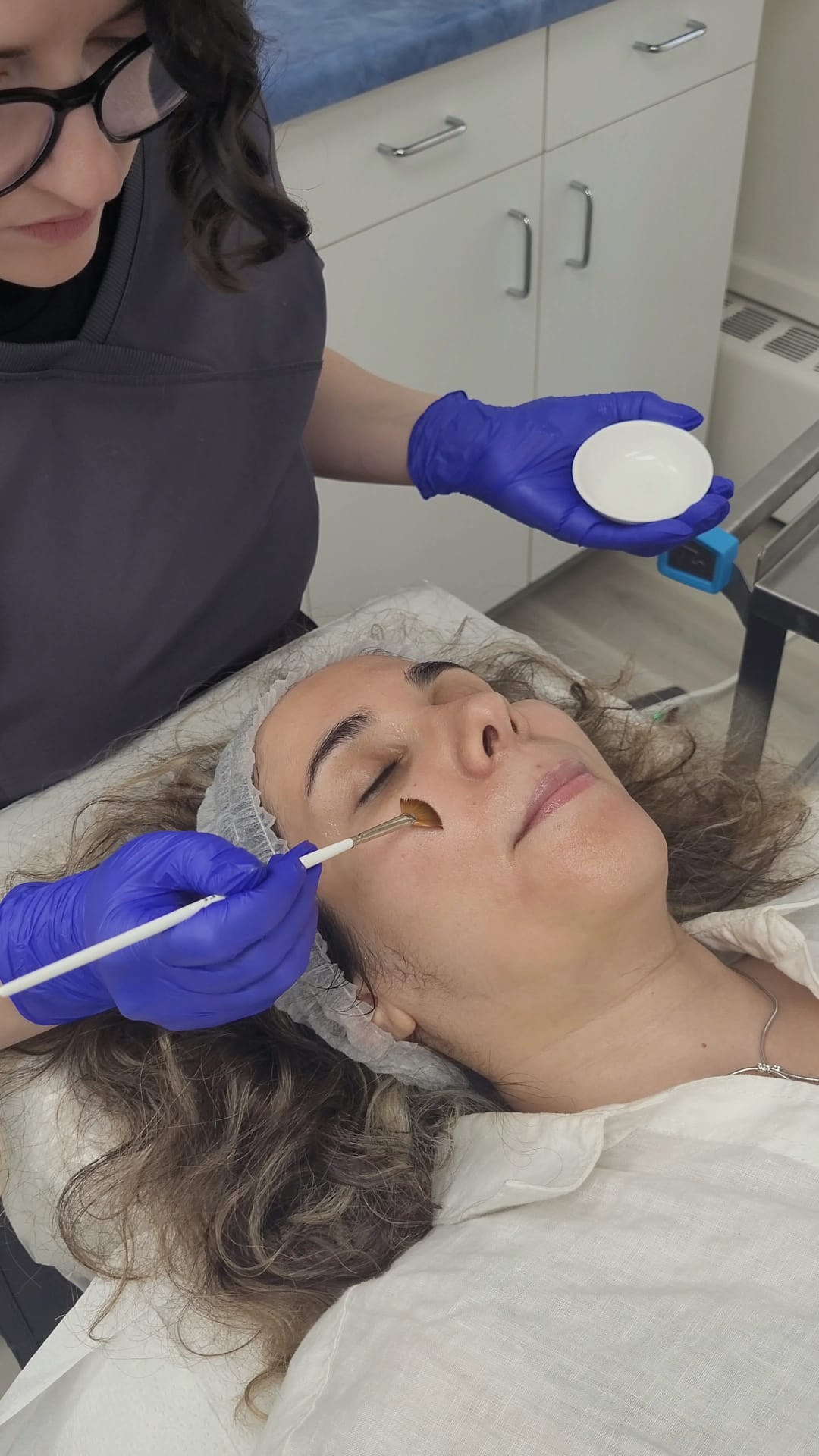 A rejuvenating chemical peel performed on a young client at Ariana Esthetic, Edmonton.