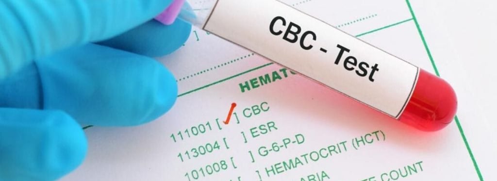 cbc test imc g10 islamabad