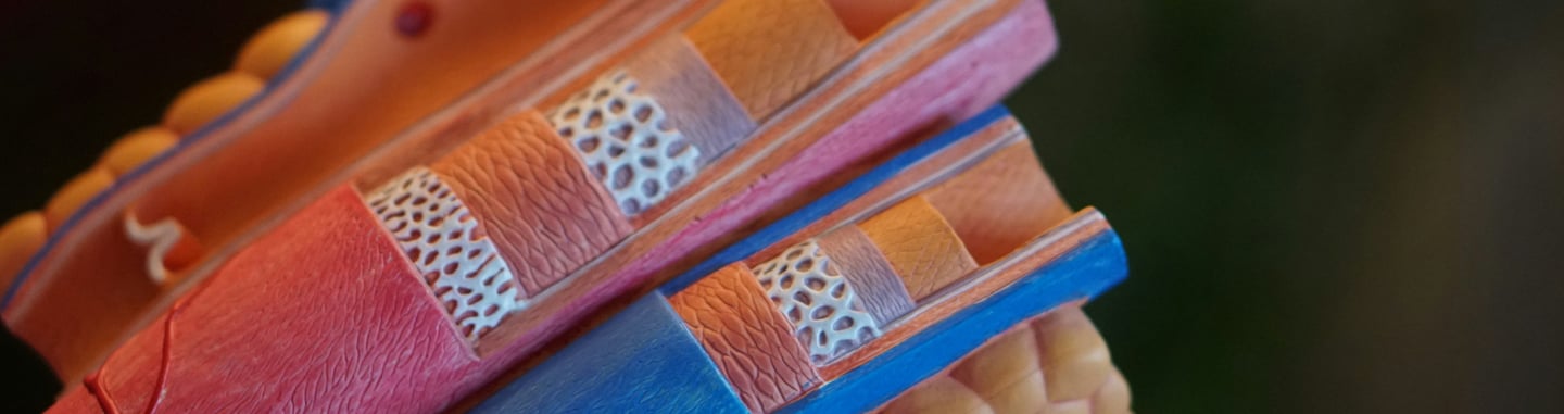 Coronary Artery Disease | CritiqoNet