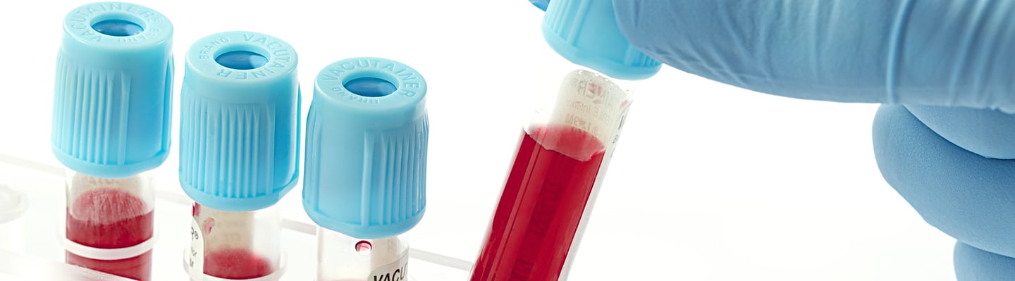 consultoría de acreditación ENAC y metrología - Consultores ISO en Marca Blanca