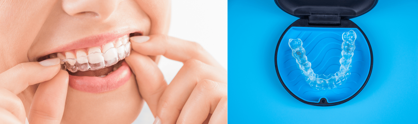Best Invisalign Provider