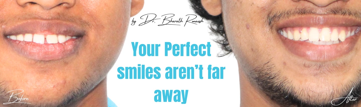 orthodontic treatment near Chromepet