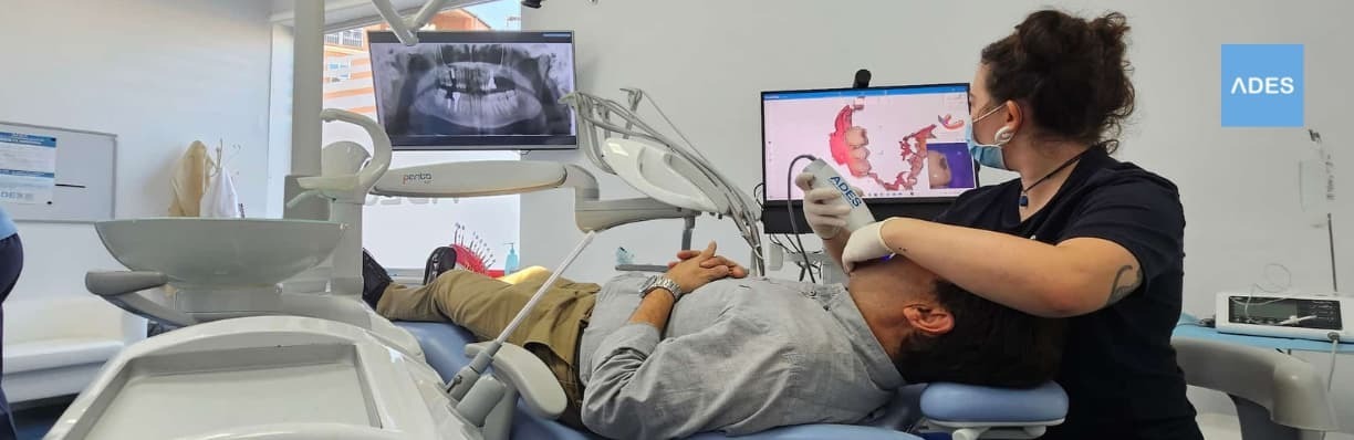 Escaneo 3d clinica dental ades