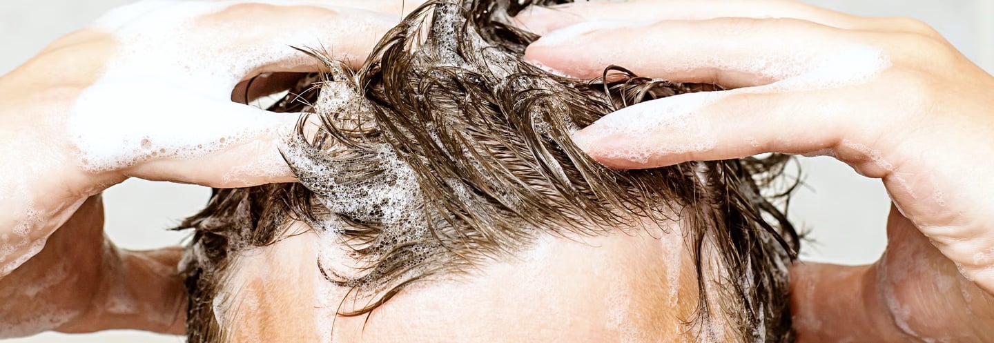 greffe de cheveux,زراعة الشعر الجزائر, perte de cheveux, تساقط الشعر, clinique greffe de cheveux,prp