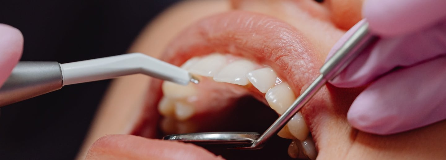 Best dental clinic in Noida