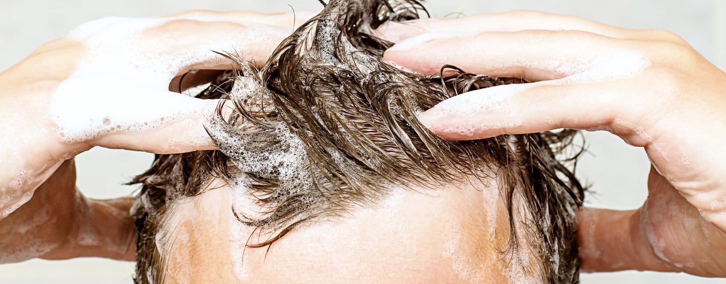 greffe de barbe, implantation capillaire homme, greffe de cheveux femme Algérie, densité capillaire