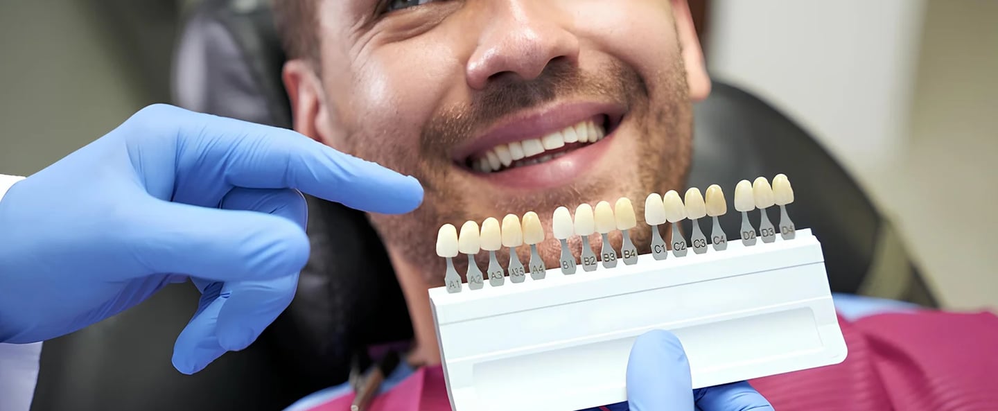 A dentist uses a tooth shade guide to match a patient's smile for teeth whitening or dental veneers.