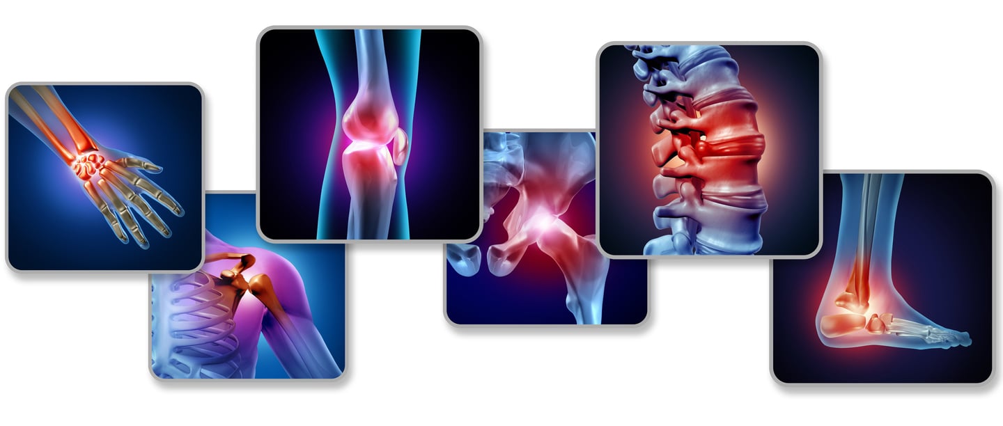 imagenes de artritis en centro de medicina alternativa novocen