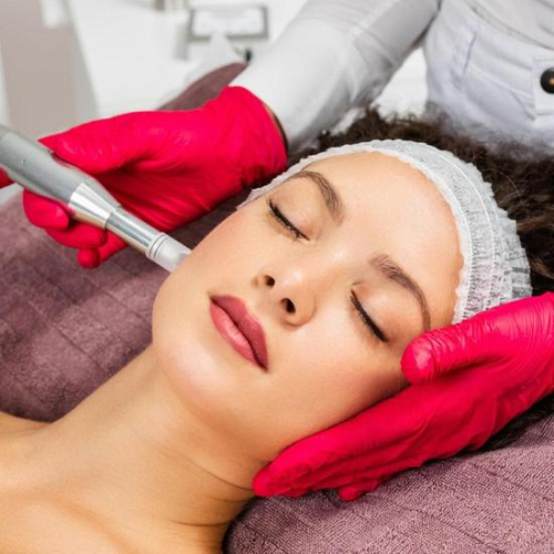 Professional facial microneedling treatment for skin rejuvenation and anti-aging therapy.