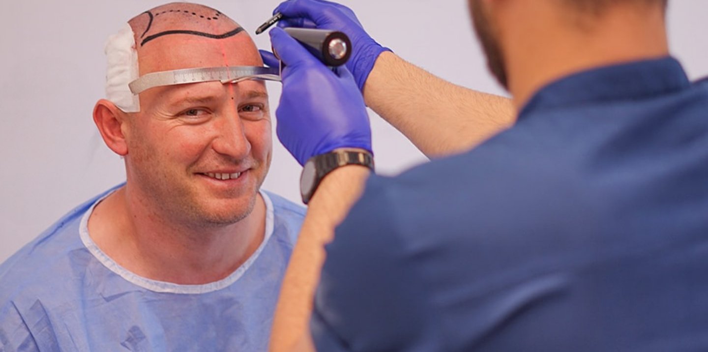 greffe de cheveux,زراعة الشعر الجزائر, perte de cheveux, تساقط الشعر, clinique greffe de cheveux,prp