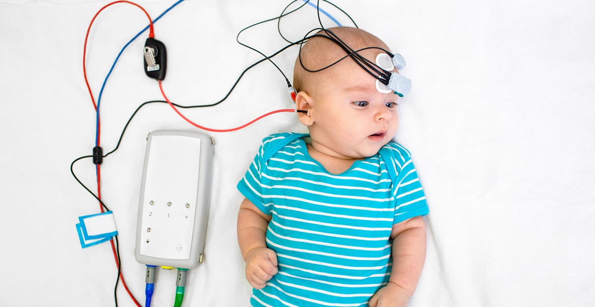 Um bebê fazendo o exame Emissões Otoacústicas