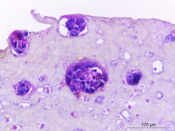 3DONCOCHIP CTI Biotech 3doncochip-cti-biotech
