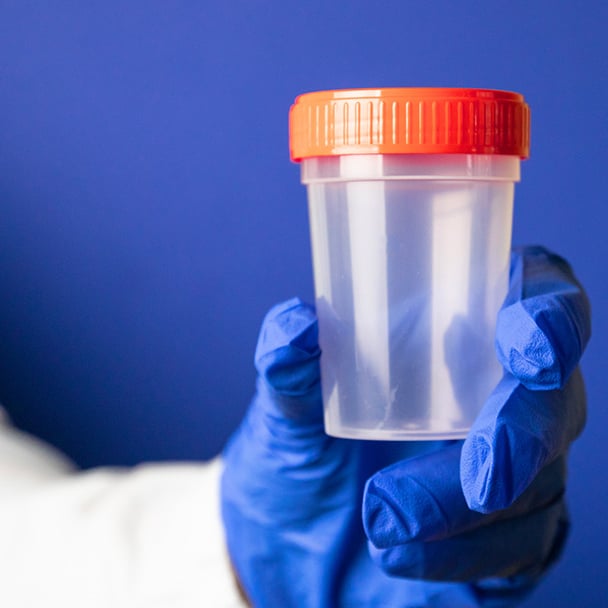 Kas tiriama šlapimo tyrimo metu? | Euromedika