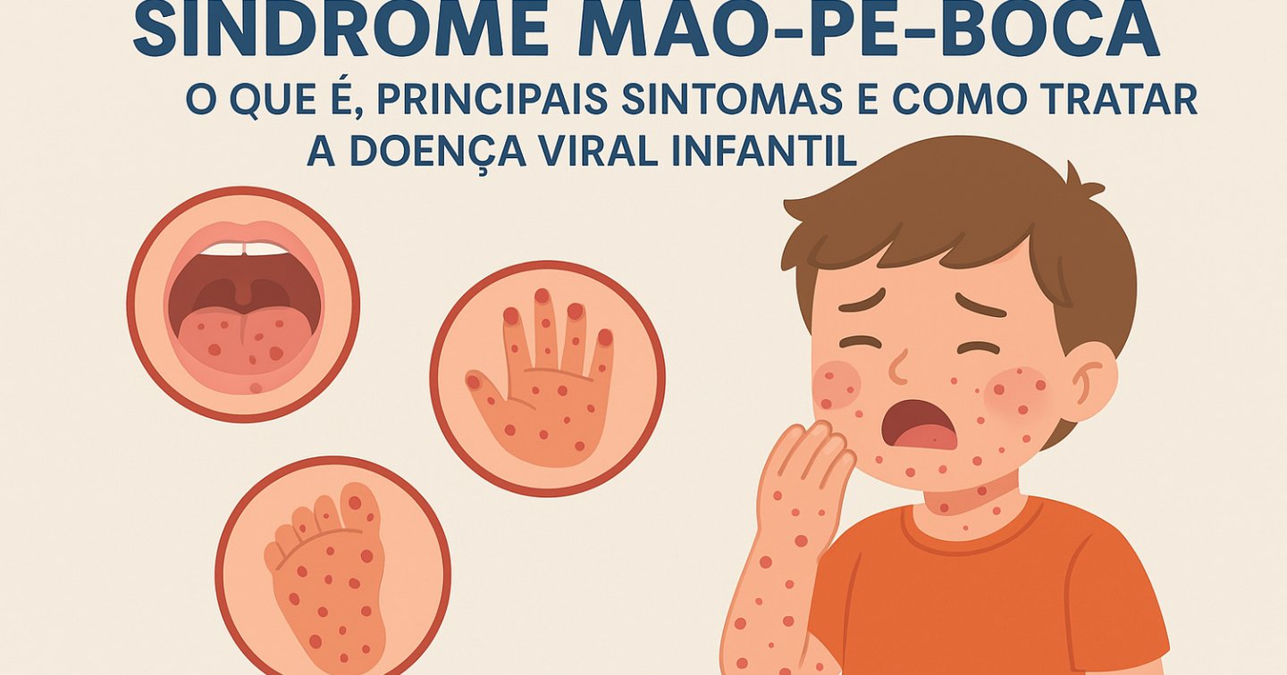 Síndrome Mão-Pé-Boca: O que é, Principais Sintomas e Como Tratar a ...