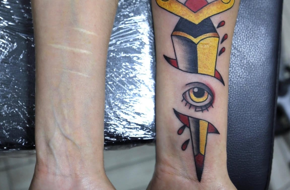Tatuajes personalizados para todo tipo de cicatrices | Secret Tattoo  Barcelona, image size:1152x756