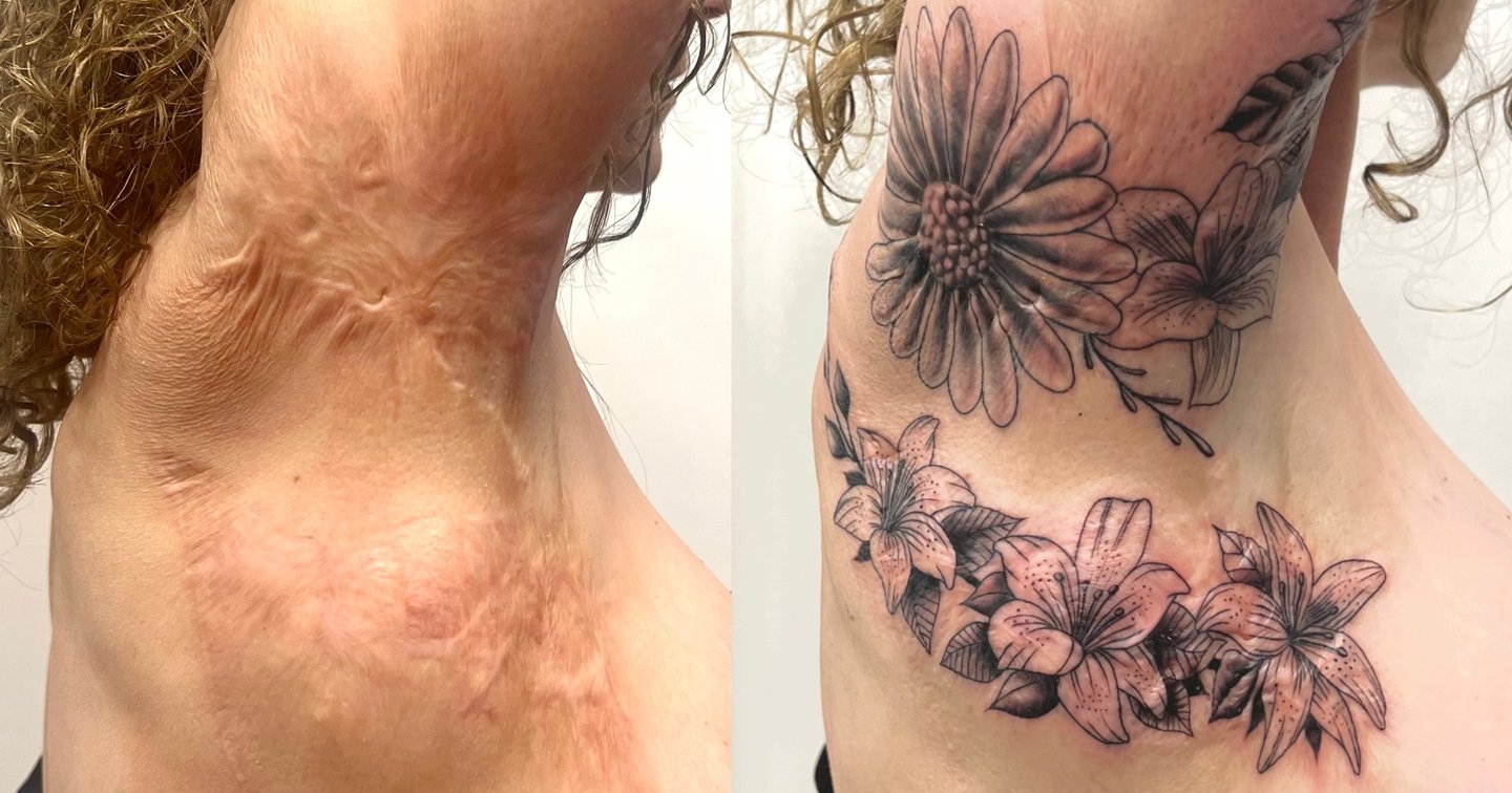 Nuria's scar: Transformation through the Art of Tattooing. | Secret Tatto  Barcelona, image size:1440x756