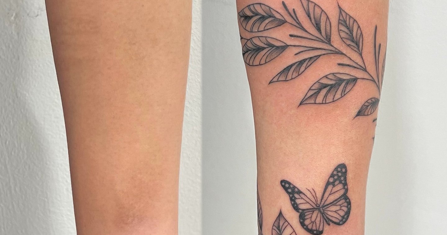 Cicatriz por quemaduras de Joi | Secret Tattoo Barcelona, image size:1440x756