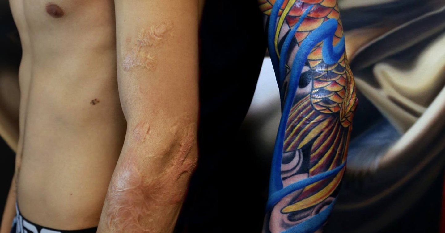 Tatuajes para cubrir cicatrices de quemaduras | Secret Tattoo Barcelona, image size:1440x756
