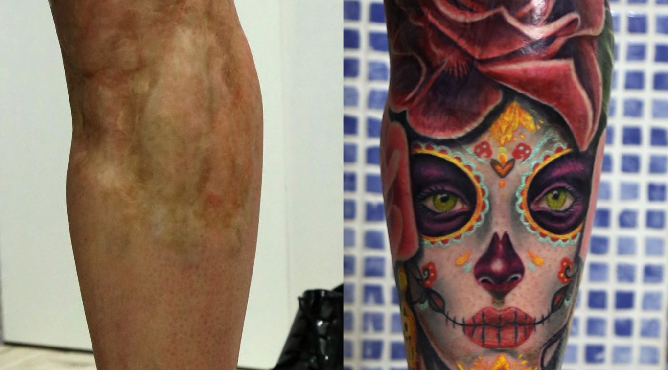 Transformación real en Barcelona | Secret Tattoo Barcelona, image size:1365x756