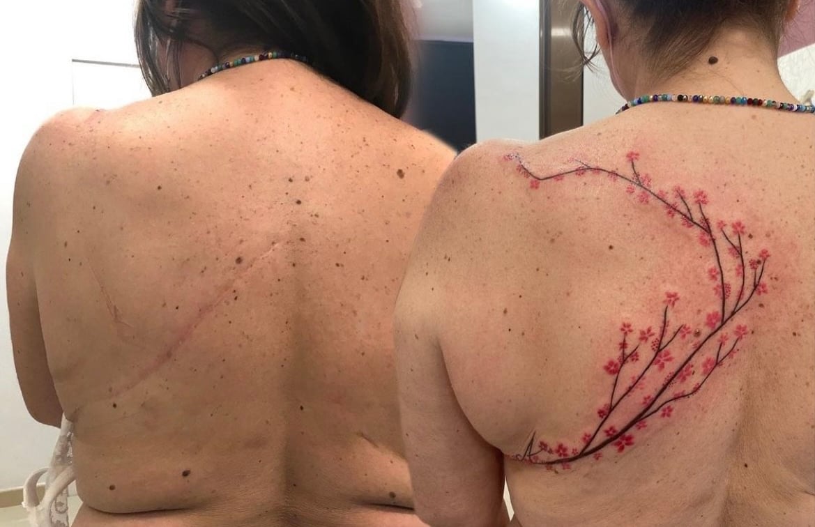 Cicatrices que inspiran: La cicatriz de Loli | Secret Tattoo Barcelona, image size:1169x756