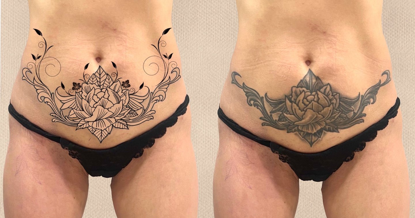 Natalia's scar: a tattoo, a new story. | Secret Tatto Barcelona, image size:1440x756