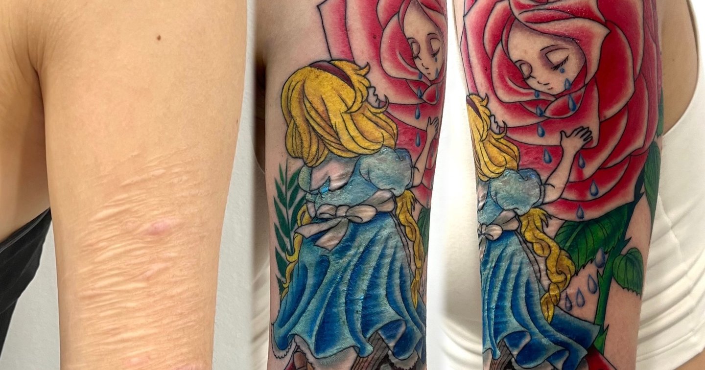 Tatuaje en cicatrices por autolesión. | Secret Tattoo Barcelona, image size:1440x756