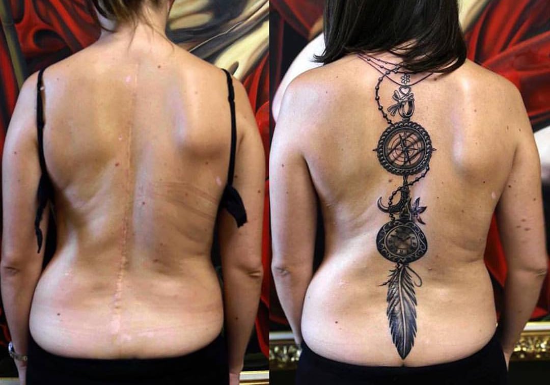 Tattoo to cover Scoliosis scars. | Secret Tatto Barcelona, image size:1080x756