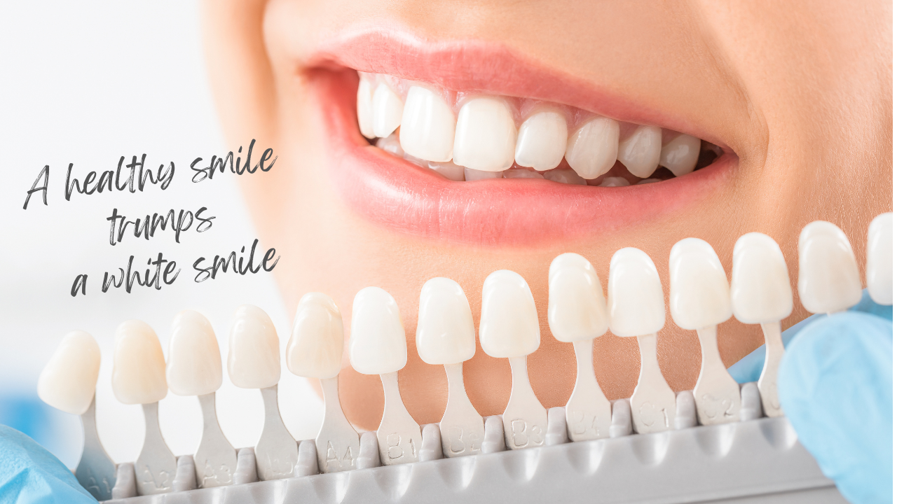 Teeth Whitening