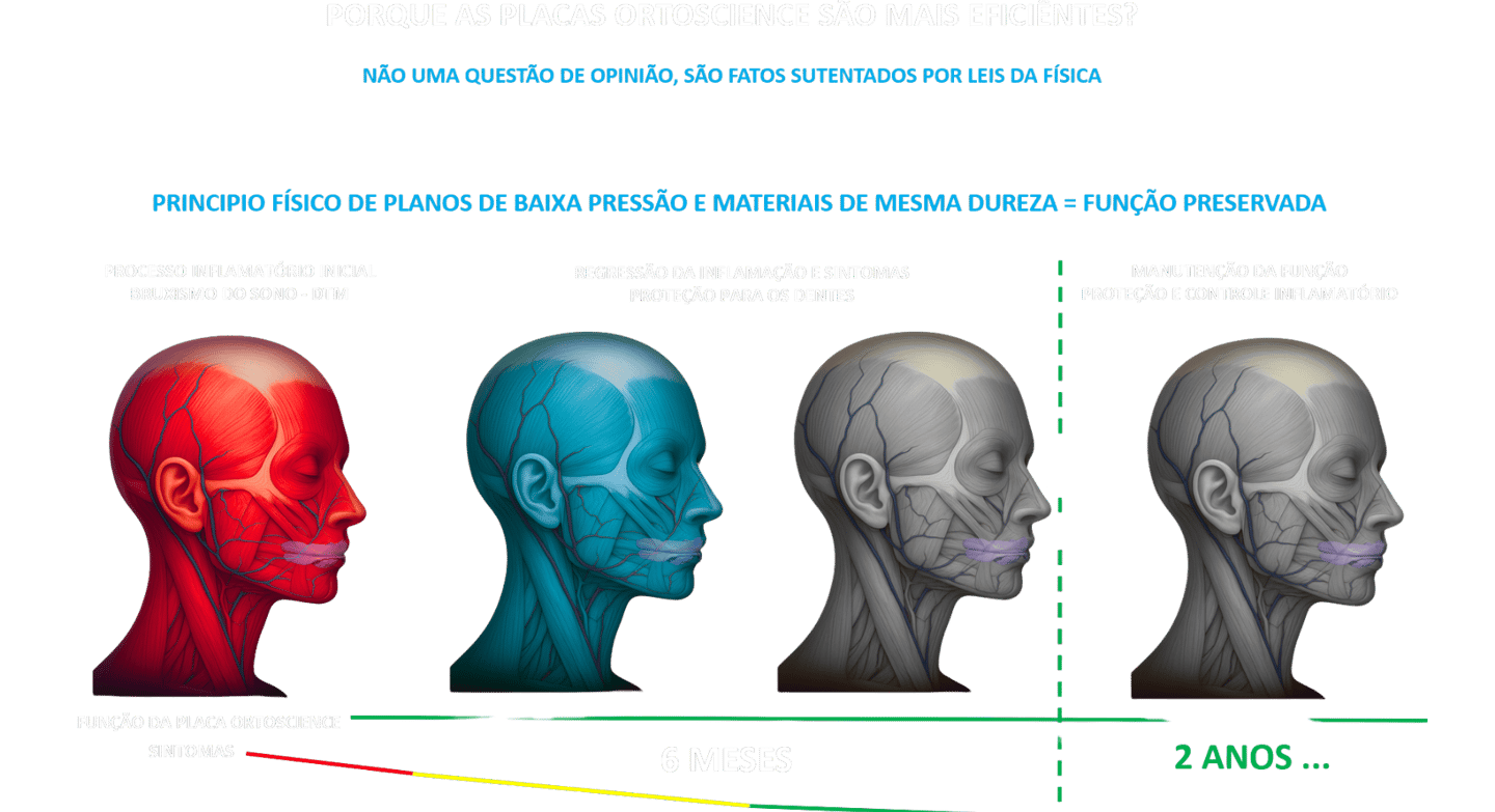 a melhor placa para bruxismo, placa Ortoscience