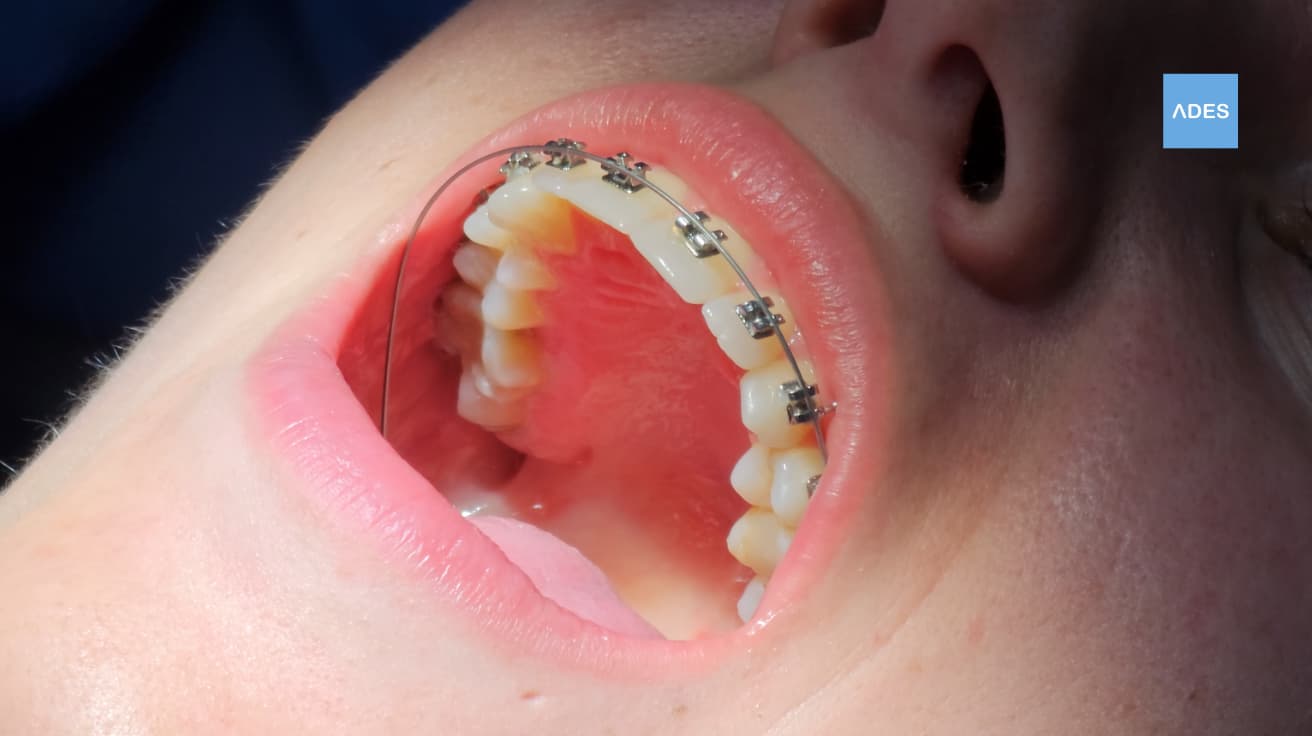 brackets metalicos badajoz