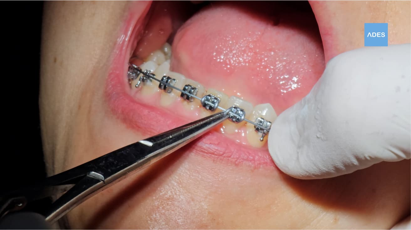 Paciente en sala de ortodoncia en Badajoz